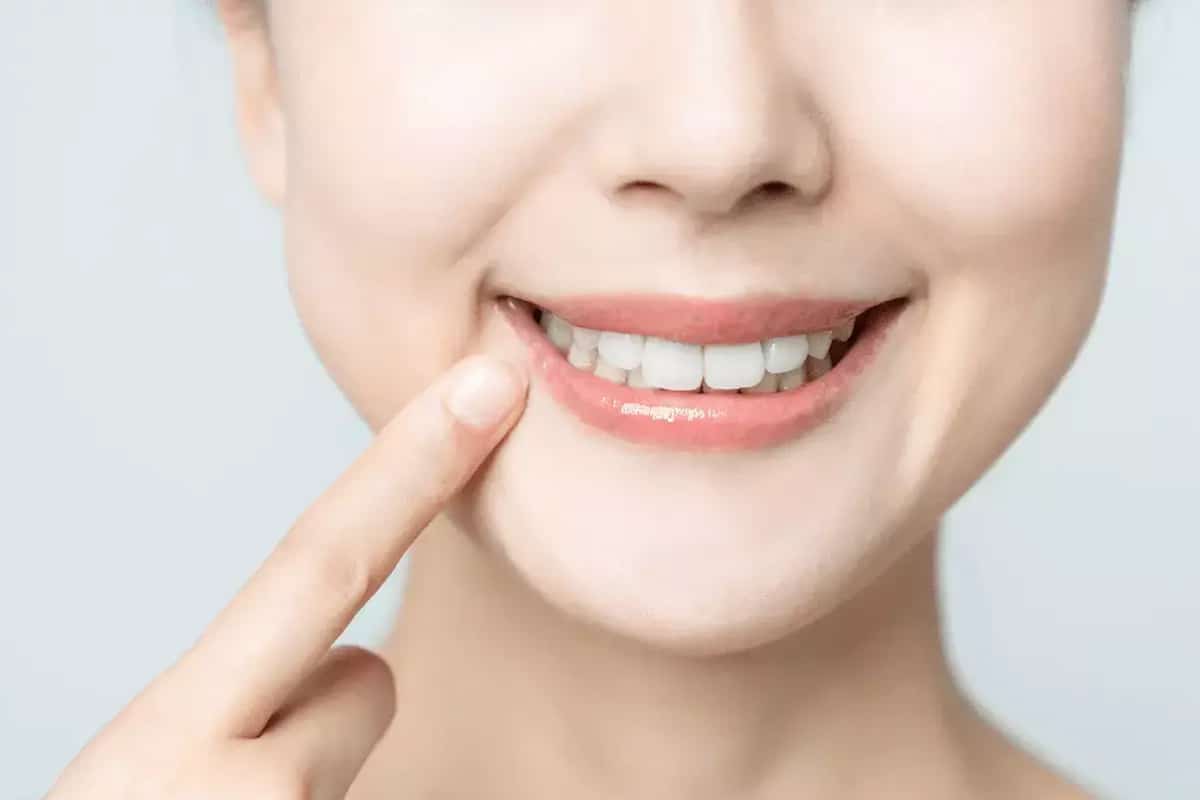Do Fillings Need to be Replaced? Here's What You Need to Know