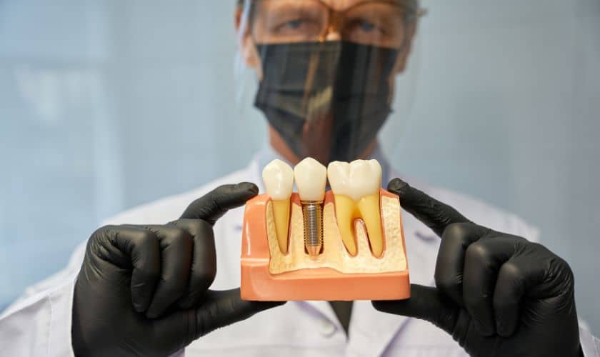 Dental Implants in Denton