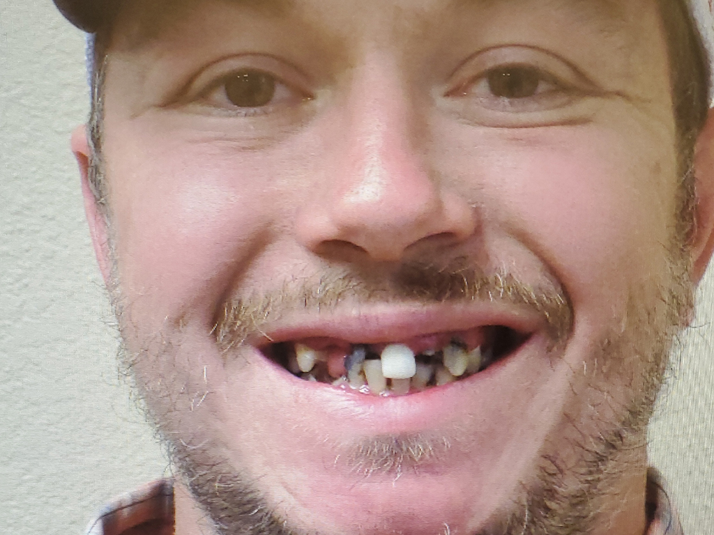 Man smiling broadly at camera, displaying teeth, indoor headshot for dental practice.