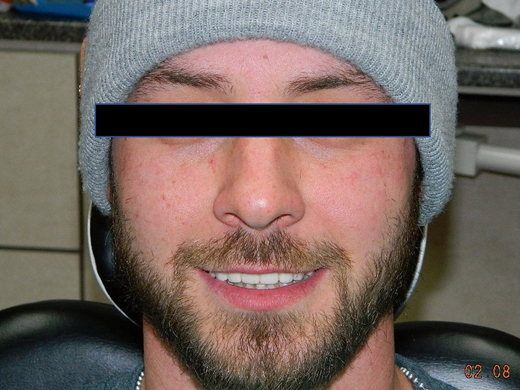 Man wearing gray beanie smiling at camera in indoor setting, eyes obscured by black bar.