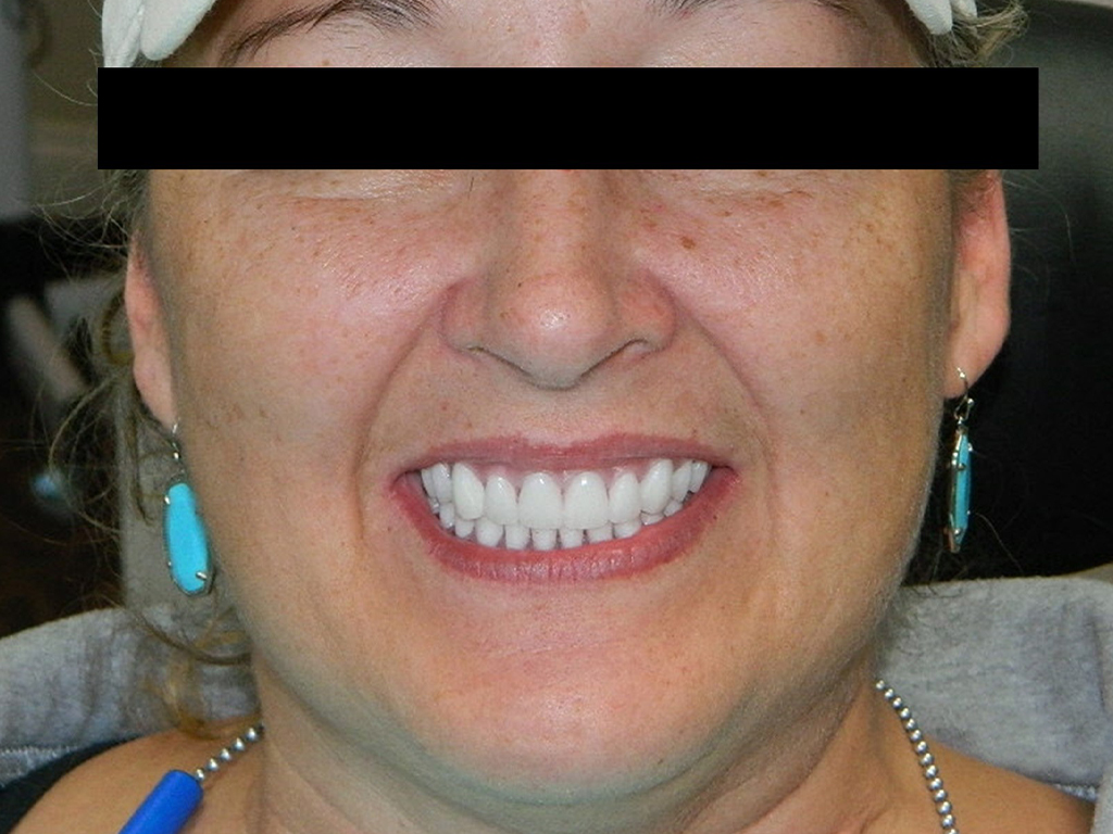 Woman smiling broadly at camera, displaying white teeth in dental office setting.
