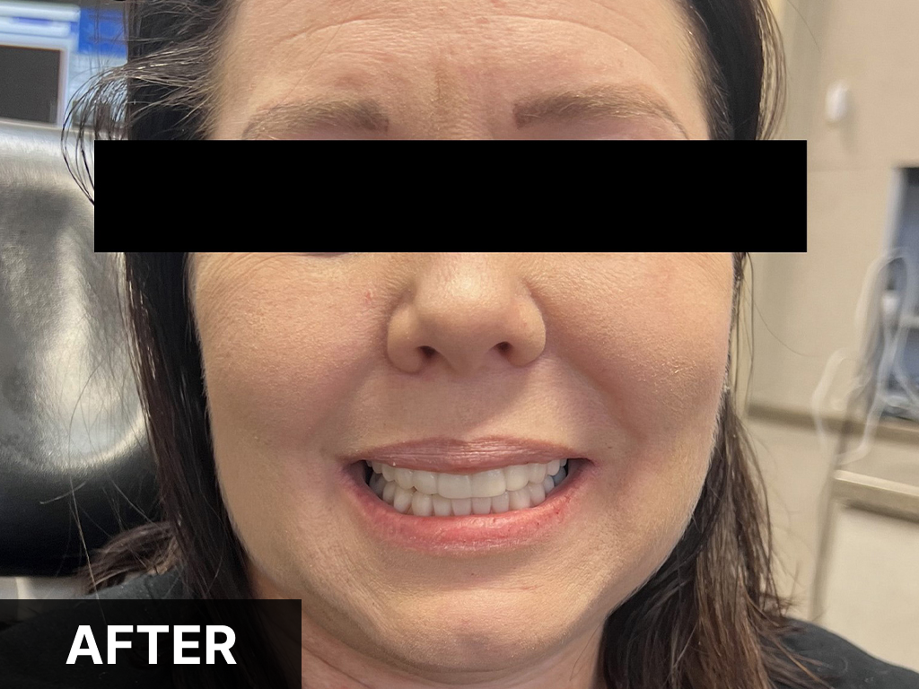 Woman smiling after dental treatment at Denton Smiles Dentistry office