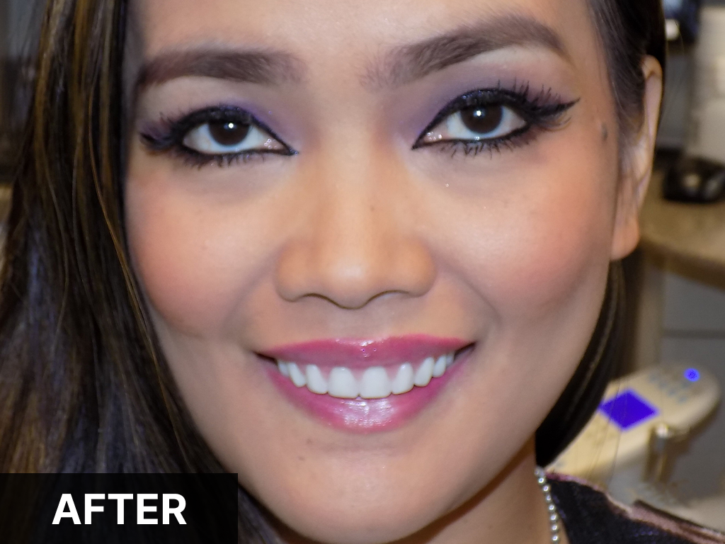 Smiling woman displaying bright white teeth after dental treatment, professional headshot.
