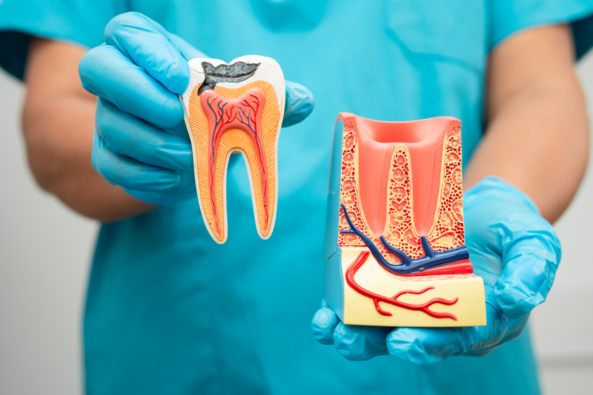 Root Canal Treatment in Denton