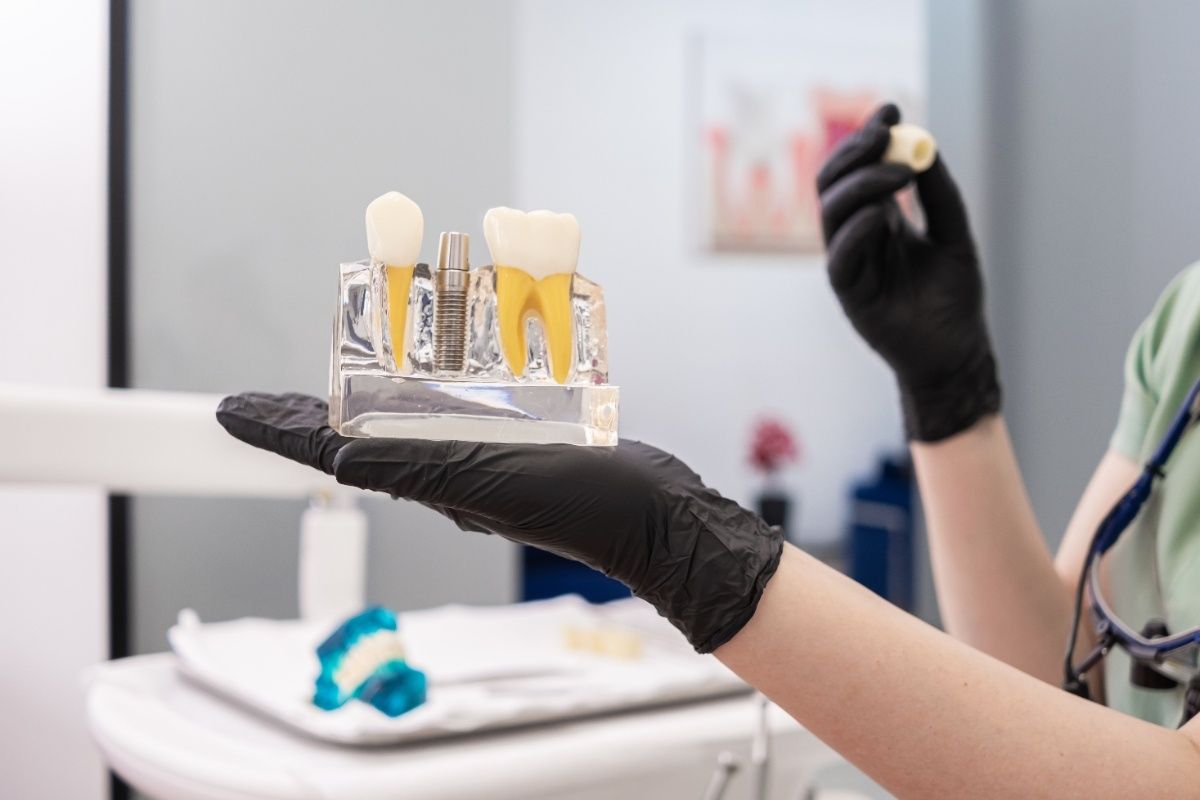 Dental Implants in Denton